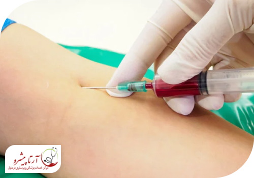 نحوه انجام آزمایش در منزل