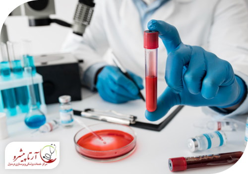 آزمایش خون؛ یکی از روش های تشخیص سرطان متاستاتیک