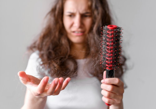 ریزش مو چیست؟ علائم، دلایل و درمان آلوپسی