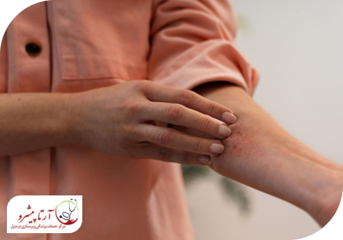 خارش پوست؛ یکی از علائم eczema