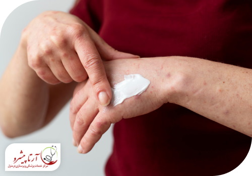 مصرف مرطوب کننده برای جلوگیری از ابتلا به اگزمای آتوپیک