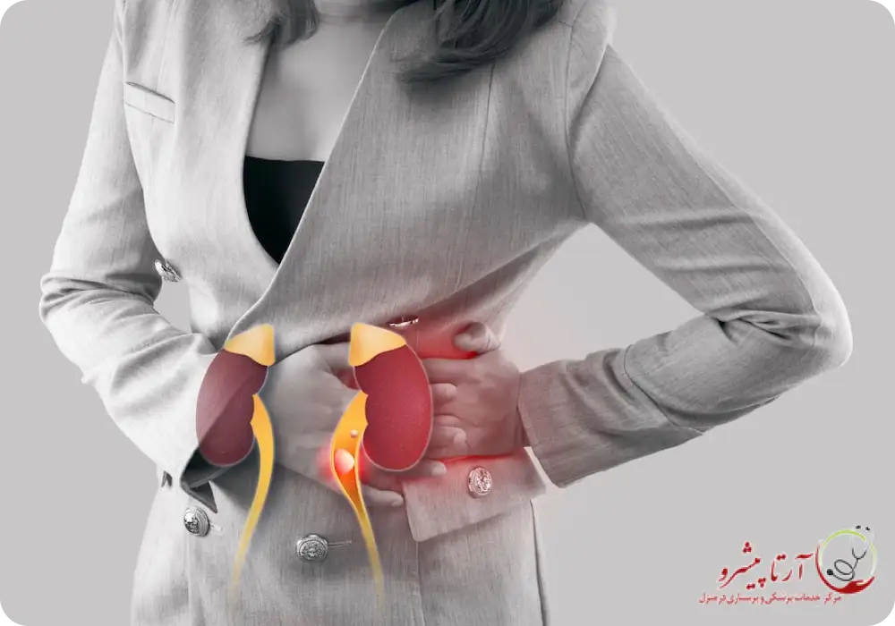 عوارض ابتلا به سنگ کلیه چیست؟